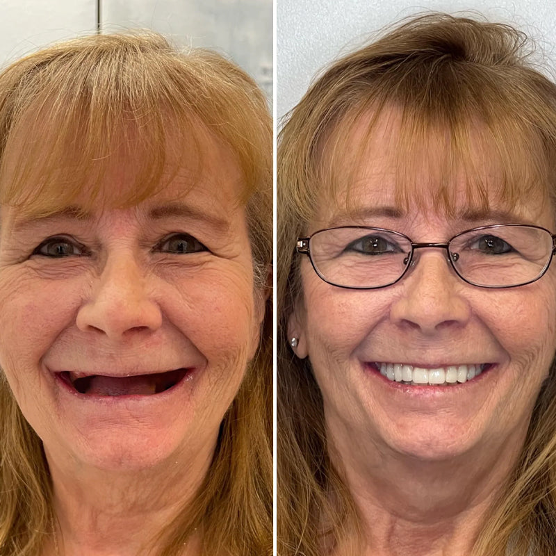 Strong All-Day Hold Denture Adhesive Cream