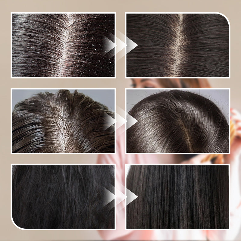 Sulfur Oil Control Anti-Dandruff Shampoo