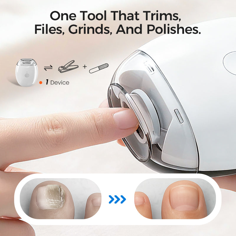 🔥2026 New Arrivals: 50% Off for a Limited Time!⚡50K+ SOLD!🔥Universal Automatic Fingernail Grinder