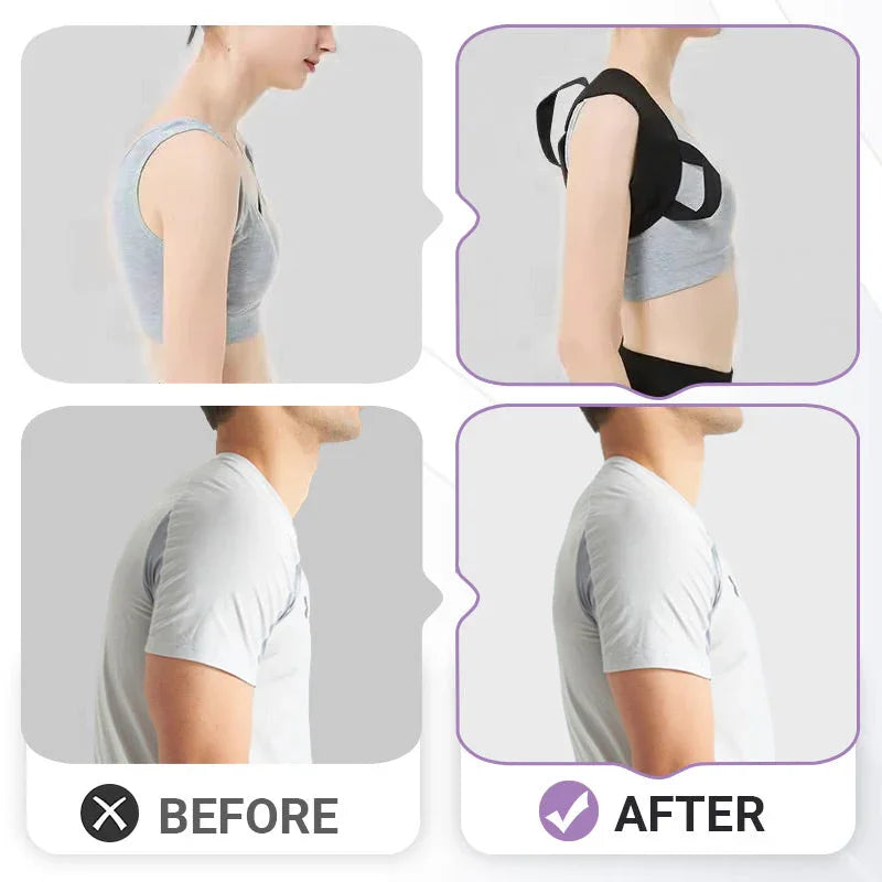 🔥Back Posture Correction Belt for Men & Women