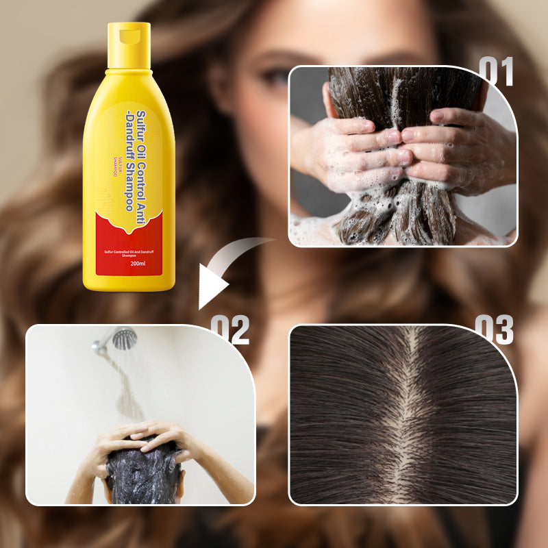 Sulfur Oil Control Anti-Dandruff Shampoo