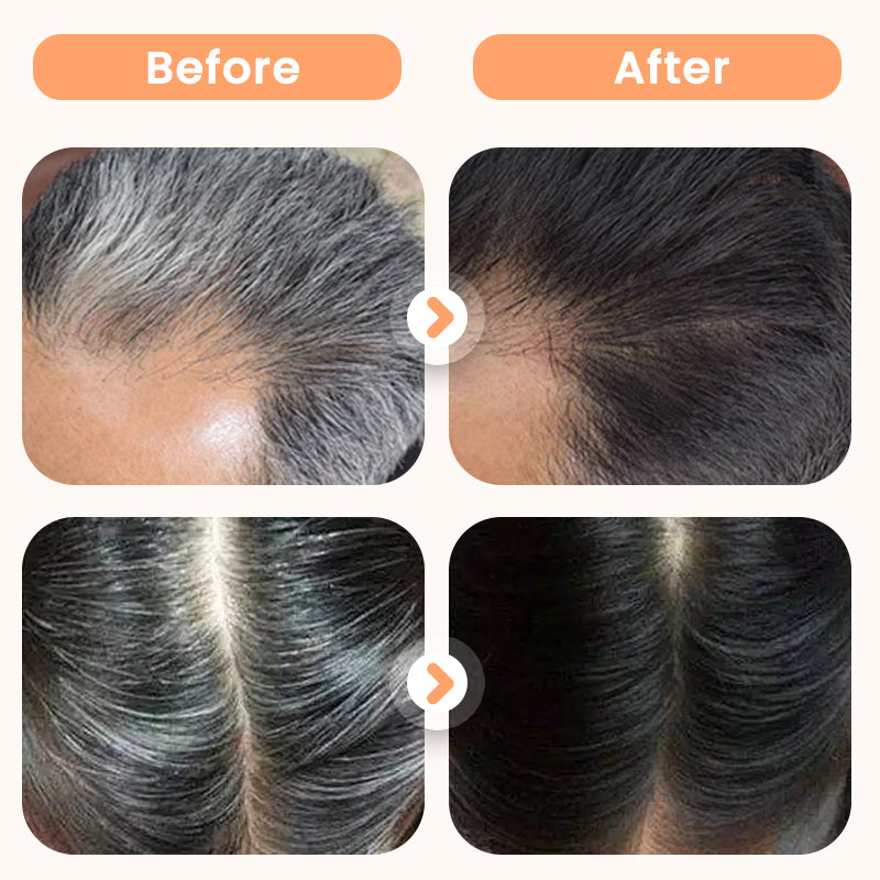 💆‍♀️🌿Plant Extract Hair Dye for Gray Hair（50% OFF）