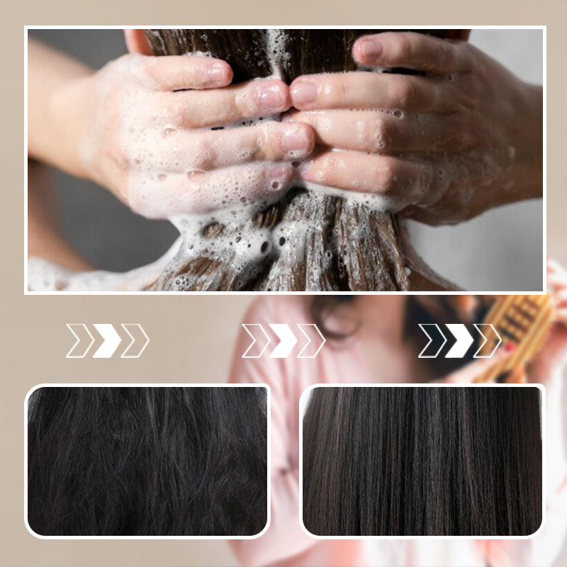 Sulfur Oil Control Anti-Dandruff Shampoo