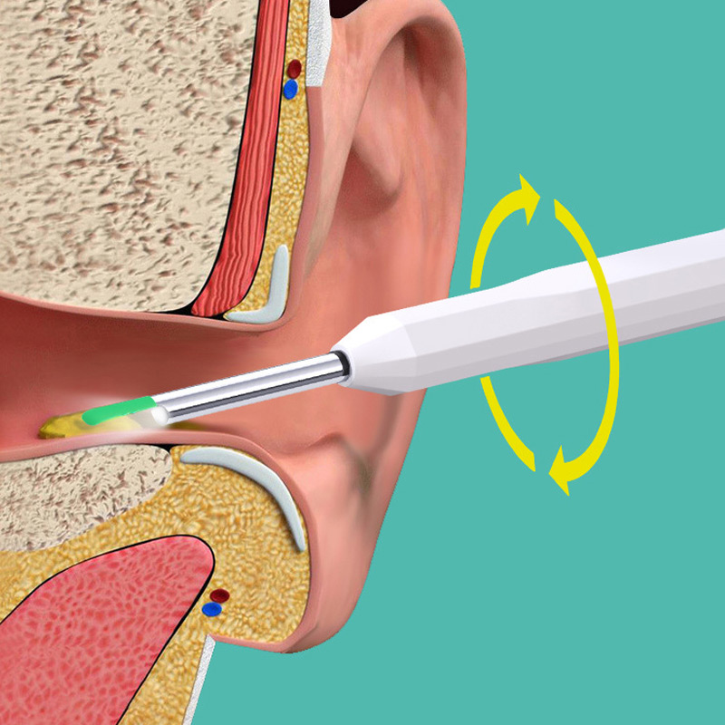 Endoscopic Visual Ear Picker